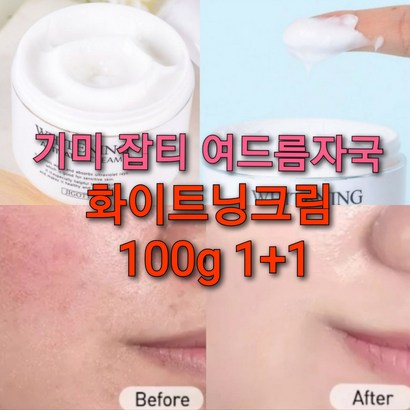 기미 검버섯 화이트닝크림 /멜라닌 크림