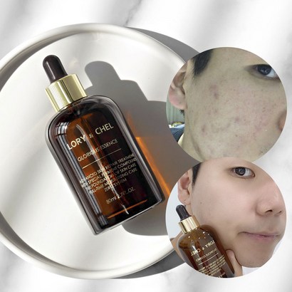 로리앤첼 글로리어스 에센스 앰플 세럼