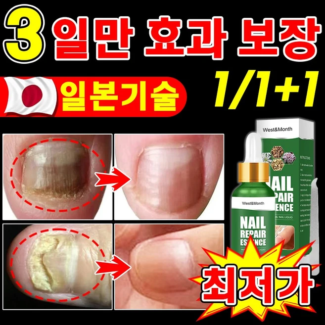 [빠른 배송] 손발톱 무좀약 무좀 치료 영양 제 내성발톱 문제성발톱 셀라솔루션 진균 리페어에센스 케어제 발톱연화 무좀 곰팡이 관리, 3개, 30ml