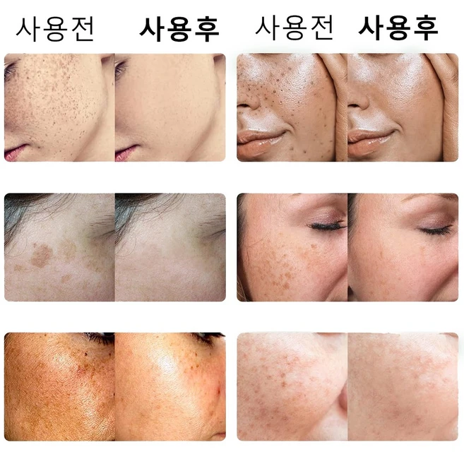 HANVIVA 기미 잡티 크림 주근깨 검버섯 갈색 반점 제거 크림 주름 개선 색소침착 개선 모공수축 크림 글루타치온 미백 크림 피부 리페어 수분 크림, 1개, 50ml