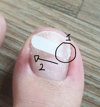 갤러리 이미지