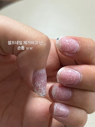 갤러리 이미지