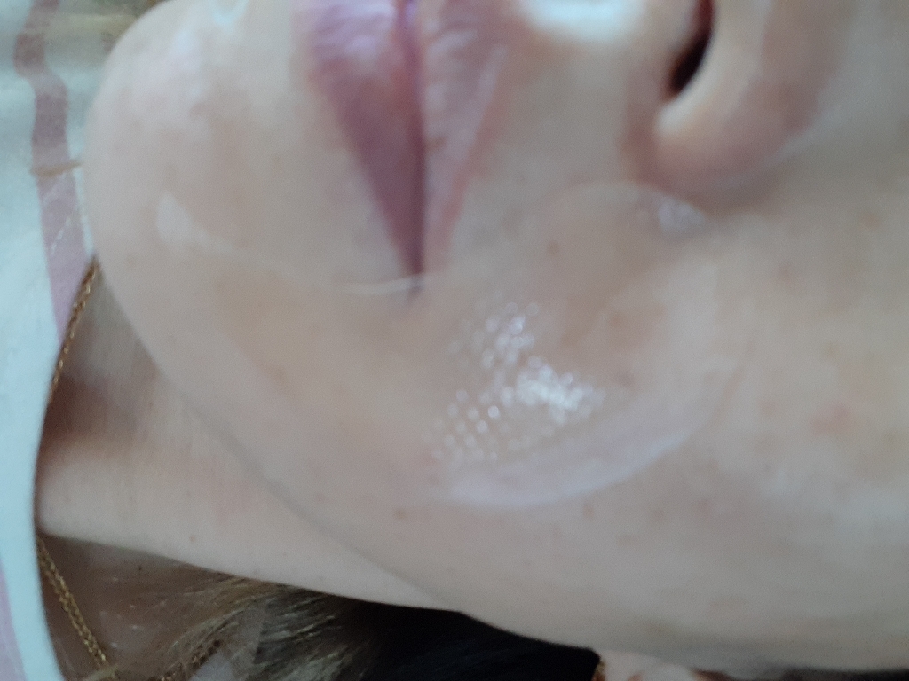 로하시스 허니 스트럭쳐 아이패치 이엑스 하이드로겔타입