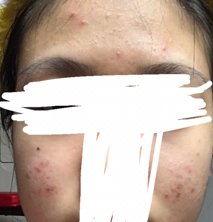 어성초 스킨토너 추출물 원액 약산성