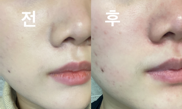 바닐라코 클린 잇 제로 클렌징밤 포어 클래리파잉 리뷰후기