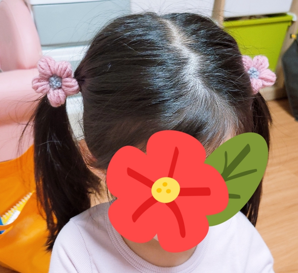 공주마마 꽃블리뜨게방울 리뷰후기