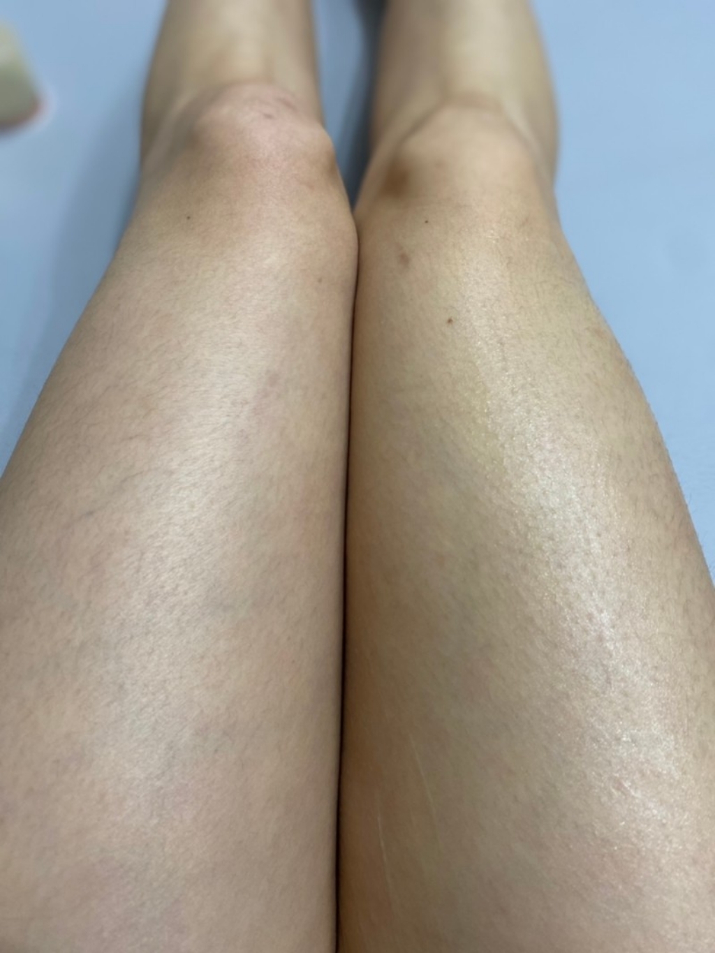 [ 이벤트  발열복부벨트 증정 ]마이크로 c 바디슬리밍 마사지 셀룰라이트크림  임상시험완료