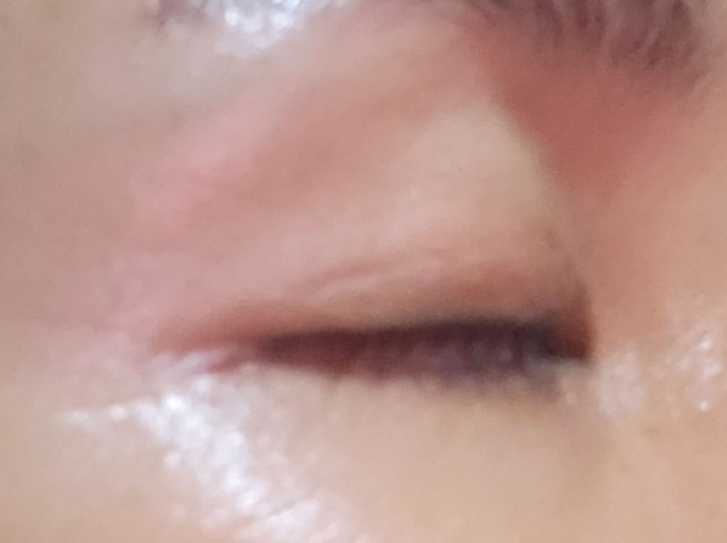 보르피린