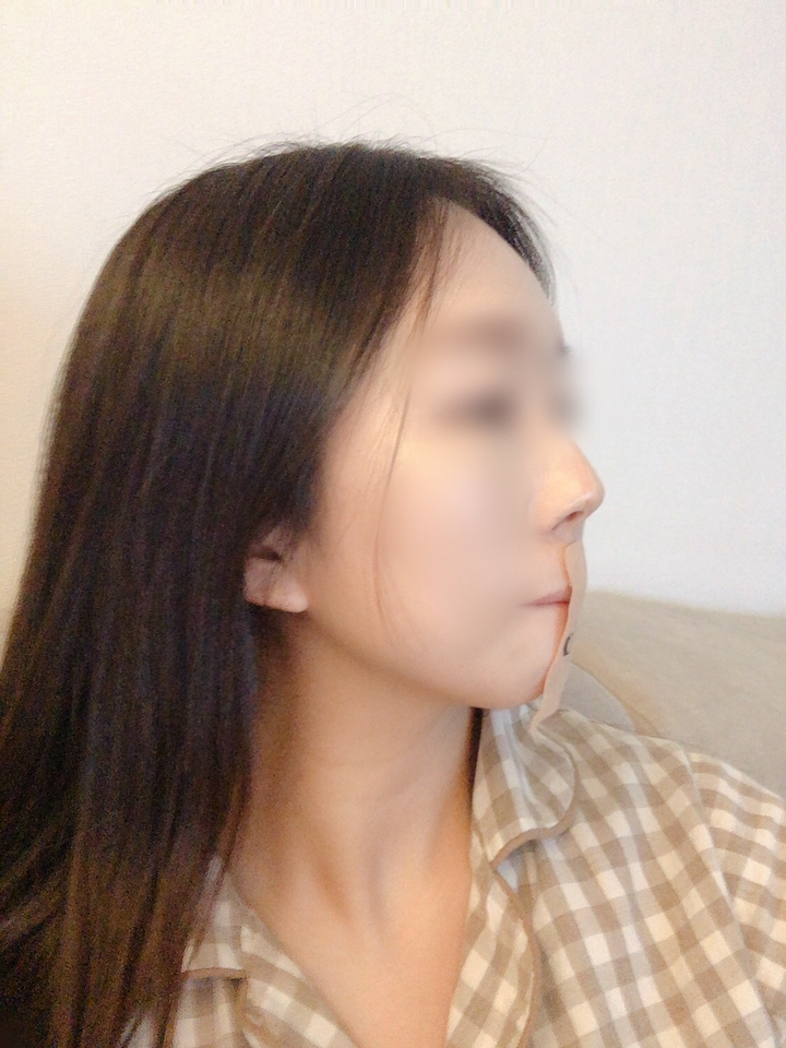 이우정한의사의 코숨테이프-입벌림방지 여성 남성 꿀잠아이템 수면루틴