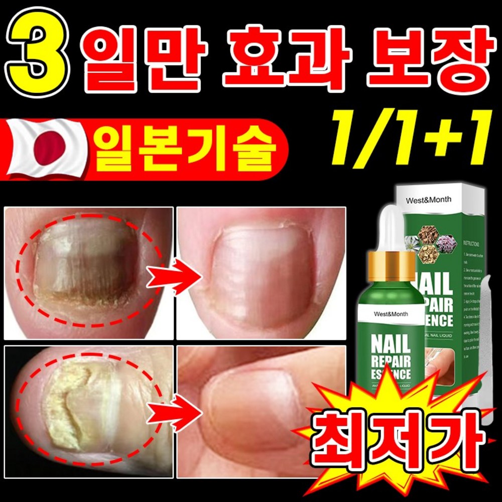[빠른 배송] 손발톱 무좀약 무좀 치료 영양 제 내성발톱 문제성발톱 셀라솔루션 진균 리페어에센스 케어제 발톱연화 무좀 곰팡이 관리, 30ml, 5개