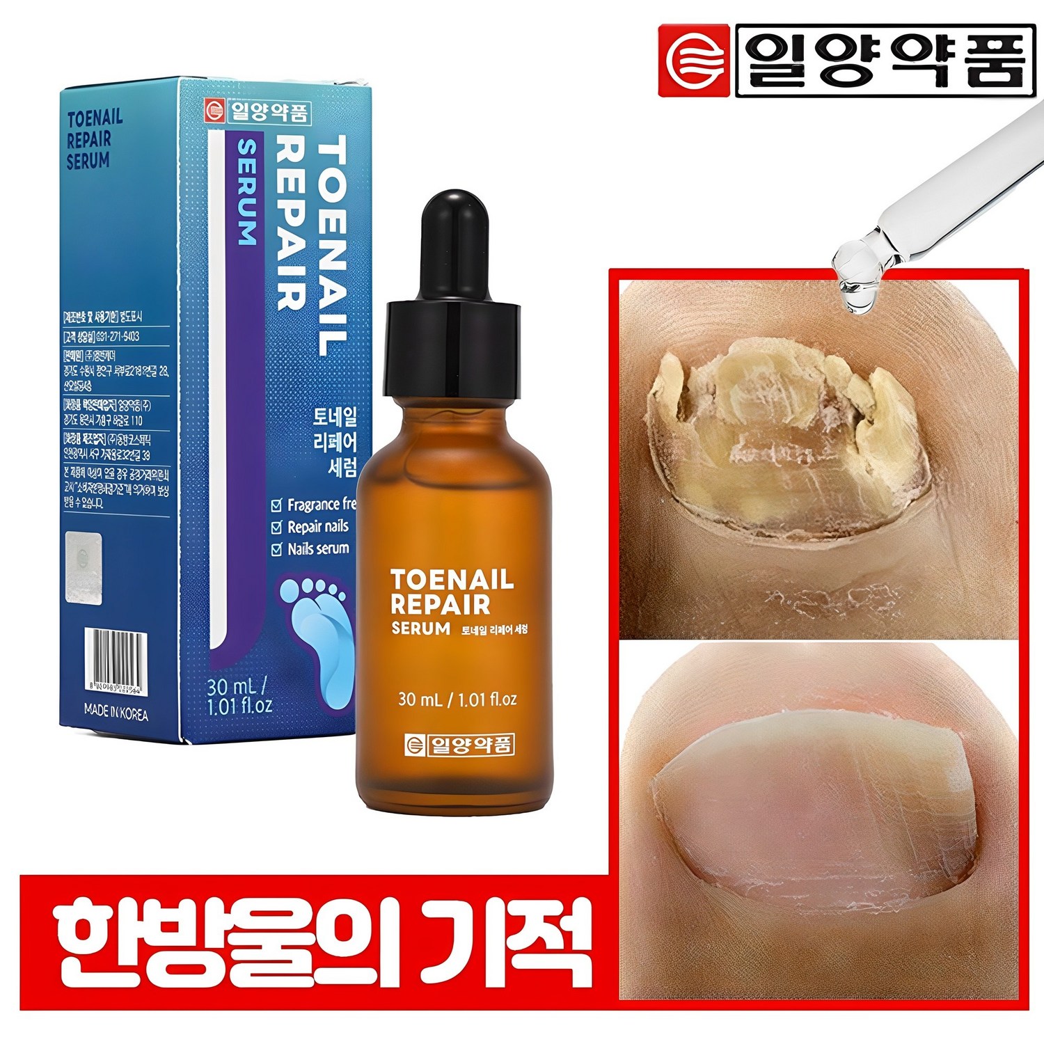 일양약품 문제성 손발톱 전문 리페어 세럼, 토네일 발톱영양제