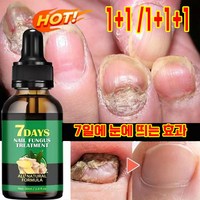 1+1 손 발톱 무좀 영양제 셀라큐어 문제성톱 네일 솔루션 리페어 앰플 에센스 톱강화, 1(1+1아님), 2개