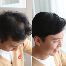 [M2002] 인모 100% 불파트 가르마형 프리스타일형 투페 남자가발, 19cmx21cm