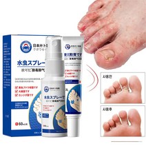 발톱 무좀약 발가락 무좀 완화 발냄새 제거 무좀 치료 세트, 1개, 60ml+20g