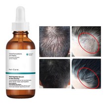 세럼 헤어 케어 일반 60ml 멀티 펩타이드 모발 밀도 성장 강도 폴리펩티드 두피, [01] 60ml