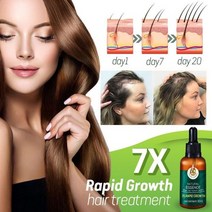 탈모약 탈모치료제 프로페시아 바르는 먹는탈모약 탈모샴푸 두피모낭염 1pc 7x 급속 성장 헤어 트리트먼트 안티 탈모 빠른 모발 성장 세럼 생강 에센셜 오일 30ml