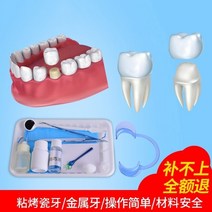 치아접착제 구타 페르카 자가사용 에나멜 특수 접착제 틀니접착제 의치접착제, 01 일반형(오픈클립+소독액)