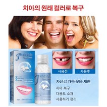 가소성 치아 보수 고체 젤 치과성분 동일 틀니 접착제 30ml 1+1세트(Set), 치아 보수 고체 젤(30ml) 2