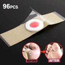 발바닥 티눈 밴드 약 제거 48 개대 발 관리 스티커 의료 석고 닭 눈 패치 의료 석고 발 제거, 48개 X 2(96개)