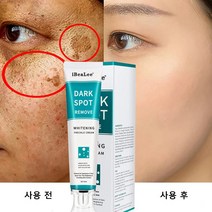 올인원 수분크림 화이트닝 모이스처크림 기미 방지 크림은 색소 침착을 완화하고 주근깨와 검버섯을 부드럽게 제거하고 미백 보습 및 순하게 수리합니다, 20g*4
