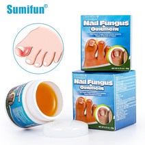 Sumifun 내성발톱 내성발톱 자가치료 내성발톱 관리 크림, 20g