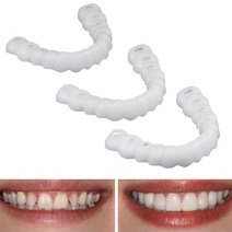 수면용 이갈이 개구기 치료 치아교정기 가드 치석제거기 3pcs 교정 교정기 치과 실리콘 치아 정렬 트레이너 리테이너 마우스, [01] 3pcs
