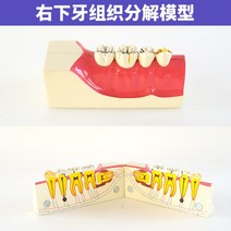 치아모형 인체모형도 치과기구 실리콘몰드 인체모형 양치교구 재료상, 오른쪽 아래 조직 분해 모델