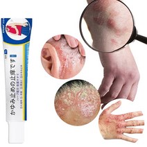 피부가려움증 건선 연고 피부염 모낭염 습진연고, 20g, 5개, 20g