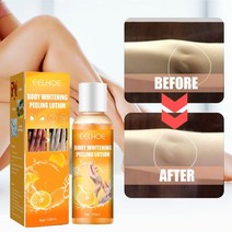 로션 화이트닝 크림 에이징 각질 바디 미백 피부 보습 비타민 C 필링 세럼 제거 무릎, 100ml, 1개