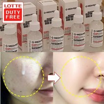 검버섯제거 에센스 30ml/7일후 놀라운변화/미백기능성앰플 기미잡티제거, 4)미백에센스1개+줄기세포마스크30+원장님아이톡 2개