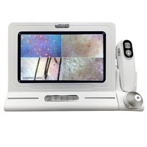 두피 피부 진단기 측정기 피부 헤어 분석기 얼굴 감지기 11inch 전문 디지털 모낭, 하얀