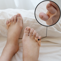 포그니 새끼 발가락 분리하게, 스킨, 3개