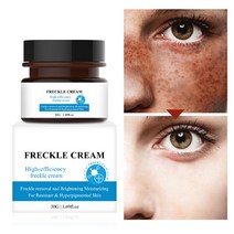 Bestevery 30g 얼굴 주근깨 제거 크림 짙은 얼룩 색소 반점 과색소침착, 1개