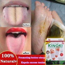 2 박스20 패드 화이트 클리닝 디톡스 키노키 풋 패치 대나무 접착식 케어 도구 수면 개선 슬리밍 스티커, 3.2PCS