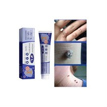 1+1+1+2 멀티 기능 스테인리스강 세정제 강력 오염 제거 녹 제거제 500g 5개, 1+1+1 피부 치료 제거연고 제거 스킨 제거 크림 2