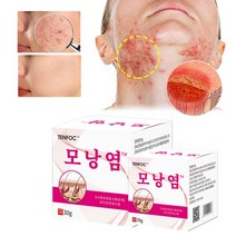 BT 피부가려움증 습진연고 지루성피부염 건선 크림 얼굴 여드름 연고, 3개, 30g