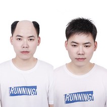 인모 남자 두피 붙이는가발 원형탈모 가벼운접착가발, 블랙_인모두피
