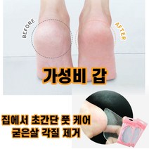 최강몰 발바닥 새끼 엄지 발가락 복숭아뼈 굳은살 각질 무좀 제거 유리 발각질제거, 1개, 유리각질제거