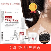 1+1 흰 반점 의학 스프레이 플러스 치료 화이트 스팟 건강 크림 백반증 질병 치료 스킨 케어, 1 스프레이 +1고약 모양
