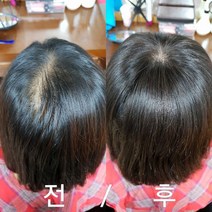 가발프랜즈 여자 정수리 부분가발 탑피스 100%인모 맞춤가발 여성가발, 1개, 내츄럴블랙 대(13X14)