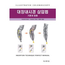 대장내시경 삽입법 기본과 응용, 북스메디컬