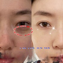 뷰티아이 백 아티팩트 남성용 에센스 다크 서클 패치 링 오일 여성 마스크, 한개옵션1, 02 84g