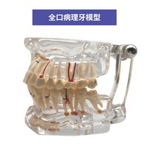 치아모형 인체모형도 치과기구 실리콘몰드 인체모형 양치교구 재료상, 32개 치아(탈착불가)