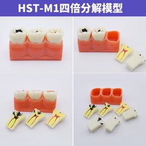 치아모형 인체모형도 치과기구 실리콘몰드 인체모형 양치교구 재료상, 4중 분해 모델