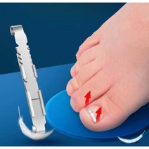 자리관리 교정 팁 내성발톱 엄지발가락 자가, (사각형 갑옷 버클 2개 팩) 세트 스타일