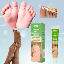 발톱 손톱연화제 영양제 큐티클제거 네일 트리트먼트 강화제손톱 곰팡이 치료 수리 크림 진균증 연고 발, 01 A1