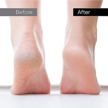 The크리스탈 실리콘 발세척매트 풋브러쉬 발각질제거 발스크럽 발바닥지압, 1개, 실리콘풋브러쉬_민트