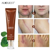 AUQUEST Scar Repair Cream 스트레치 마크 여드름 제거 촉진 세포 재생 주근깨 제거 스킨 케어, AcneScarRemover, 하나