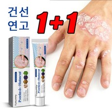 1+1 피부가려움증 연고 지루성피부염 모낭염 연고 여드름 크림, 20g, 2개 - 낭습증연고