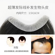 엠라인헤어패치